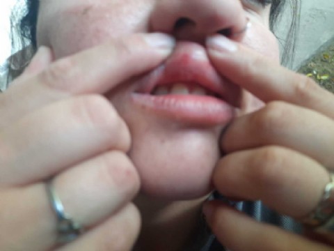 Brutal agresión de vendedores y carreros a inspectoras municipales