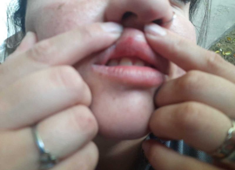 Brutal agresión de vendedores y carreros a inspectoras municipales