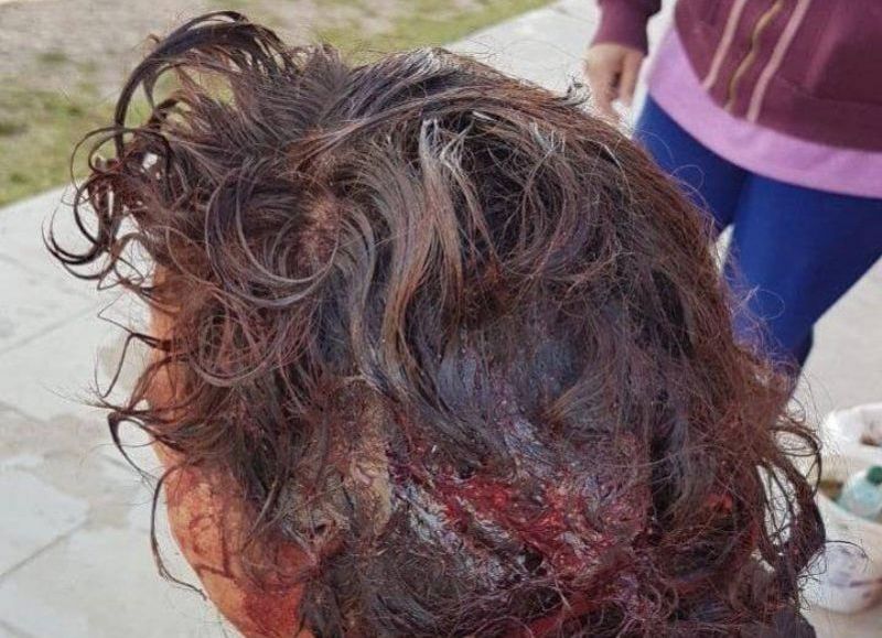 La mujer víctima del ataque en Santa Cruz llegó a Salta