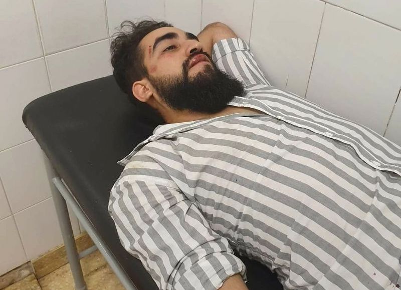 La maldita "moda" de los rugbiers violentos llegó a Salta: golpearon brutalmente a un joven